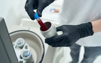 Regeneración con plasma en odontología en Madrid: la tecnología biológica que está revolucionando la curación dental